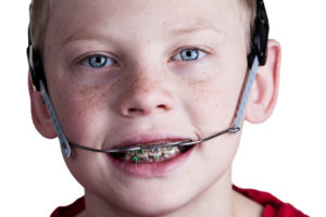 Young boy with braces and headgear to correct bite and alignment problems
