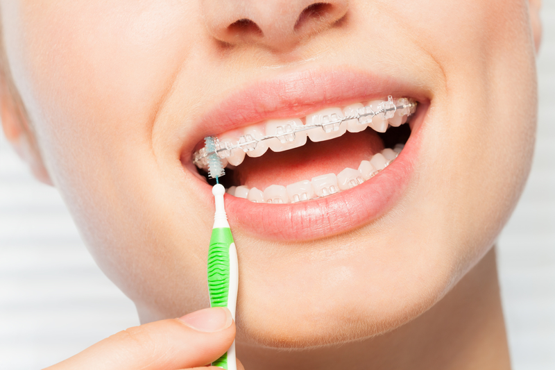 Woman that is cleaning her braces brackets with an interdental brush.