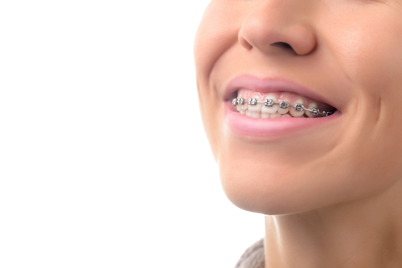 Picture of young adult wearing braces and smiling