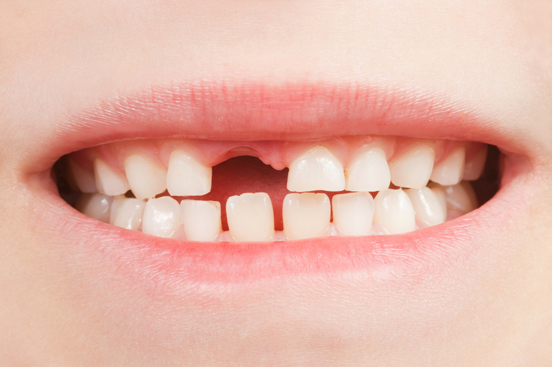 Up close view of child smiling with a missing tooth